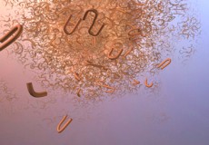Alzheimerjeva demenca – Amiloid beta – Bioresonanca